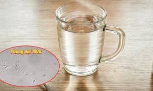 Bất ngờ khi soi nước sôi để nguội dưới kính hiển vi, 3 loại nước lọc không nên uống để tránh nhiễm độc